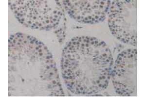 Figure. (TICAM1 antibody  (AA 263-526))