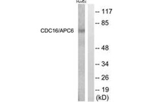 Western blot analysis of extracts from HuvEc cells, using CDC16/APC6 (Ab-560) Antibody. (CDC16 antibody  (AA 526-575))