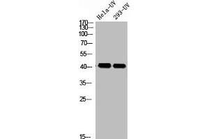 Western blot analysis of HELA-UV 293T-UV using p-Rad51 (T309) antibody. (RAD51 antibody  (pThr309))