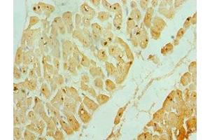 Immunohistochemistry of paraffin-embedded human heart tissue using ABIN7142987 at dilution of 1:100 (ASAH1 antibody  (AA 146-395))