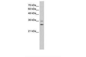 Image no. 1 for anti-Forkhead Box Q1 (FOXQ1) (N-Term) antibody (ABIN6736598) (FOXQ1 antibody  (N-Term))