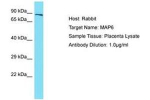 Image no. 1 for anti-Microtubule-Associated Protein 6 (MAP6) (AA 360-409) antibody (ABIN6750439) (MAP6 antibody  (AA 360-409))