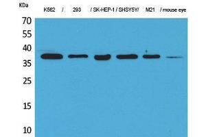 Western Blotting (WB) image for anti-Ribosomal RNA Processing 7 Homolog A (RRP7A) (C-Term) antibody (ABIN3178144) (RRP7A antibody  (C-Term))