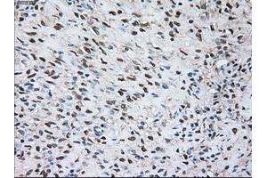 Immunohistochemical staining of paraffin-embedded Kidney tissue using anti-SIGLEC9mouse monoclonal antibody. (SIGLEC9 antibody)