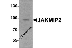 Western Blotting (WB) image for anti-Janus Kinase and Microtubule Interacting Protein 2 (JAKMIP2) antibody (ABIN1077420)