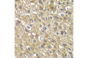 Immunohistochemistry of paraffin-embedded human liver injury using MYBPC2 antibody (ABIN6291568) at dilution of 1:100 (40x lens). (MYBPC2 antibody)