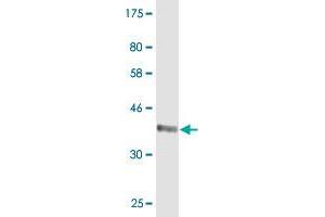 DFNB31 antibody  (AA 808-907)