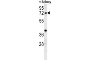 Western Blotting (WB) image for anti-Kelch-Like 6 (KLHL6) antibody (ABIN3002443) (KLHL6 antibody)