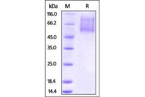 Biotinylated Human CX3CL1, His Tag on SDS-PAGE under reducing (R) condition.