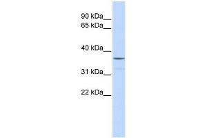WB Suggested Anti-ZNF787 Antibody Titration:  0.