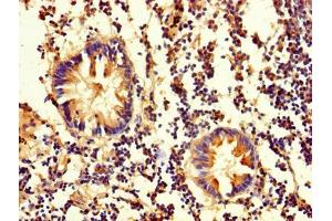 Immunohistochemistry of paraffin-embedded human appendix tissue using ABIN7162111 at dilution of 1:100 (OLA1 antibody  (AA 1-396))