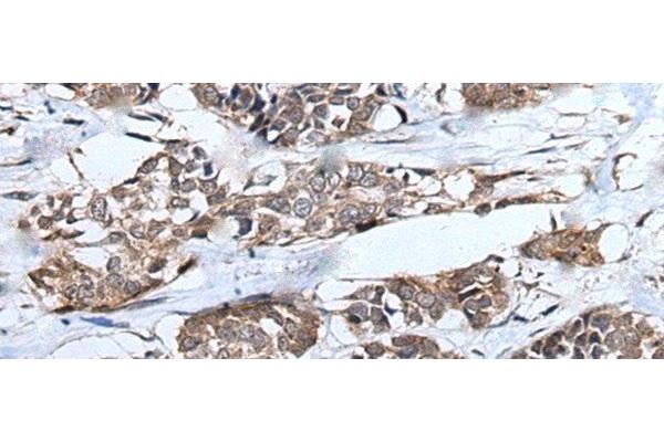 UBE4B antibody