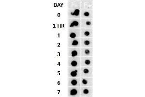Dot blot analysis using Rabbit Anti-Amyloid Fibrils (OC) Polyclonal Antibody . (Amyloid antibody (Biotin))