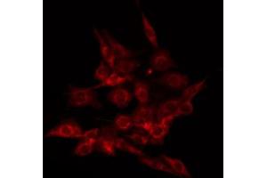 ABIN6266473 staining HuvEc by IF/ICC. (ALOX5 antibody  (pSer523))