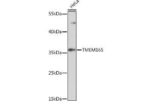 TMEM165 抗体  (AA 172-230)