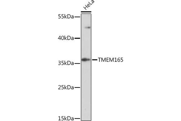 TMEM165 Antikörper  (AA 172-230)