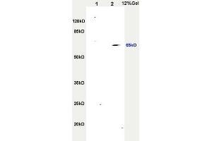 SDS-PAGE (SDS) image for anti-Tumor Necrosis Factor Receptor Superfamily, Member 11a, NFKB Activator (TNFRSF11A) (AA 51-150) antibody (ABIN749258)