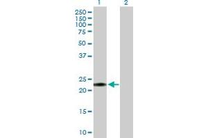 Western Blot analysis of GLIPR1L1 expression in transfected 293T cell line by GLIPR1L1 MaxPab polyclonal antibody.