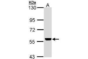 WB Image Sample (30 ug of whole cell lysate) A: Hela 7. (ADCK4 antibody  (Center))
