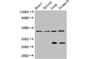Western Blot Positive WB detected in: Mouse heart tissue, Mouse spleen tissue, Mouse lung tissue, Mouse stomach tissue All lanes: REN antibody at 3 μg/mL Secondary Goat polyclonal to rabbit IgG at 1/50000 dilution Predicted band size: 46, 45 kDa Observed band size: 46, 29 kDa (Renin antibody  (AA 229-398))