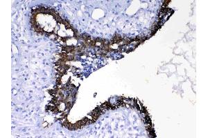 IHC analysis of Cytokeratin 8 using anti- Cytokeratin 8 antibody . (KRT8 antibody  (AA 107-325))