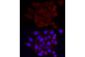 Immunofluorescence analysis of HeLa using Vinculin Rabbit mAb (ABIN3016604, ABIN3016605, ABIN1680530 and ABIN1680531) at dilution of 1:100 (40x lens). (Vinculin antibody)