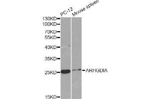 Western blot analysis of extracts of various cell lines, using ARHGDIA antibody (ABIN6291256) at 1:1000 dilution. (ARHGDIA antibody)
