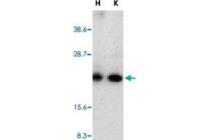 Western blot analysis of CRADD in whole cell lysates from HeLa (H) or K-562 (K) cells with CRADD polyclonal antibody  at 1 : 500 dilution.