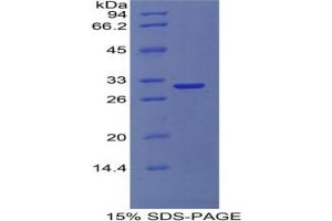 SDS-PAGE analysis of Human COL4A1 Protein. (COL4A1 Protein)