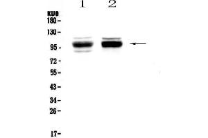 Western blot analysis of SATB1 using anti-SATB1 antibody . (SATB1 antibody  (AA 638-763))