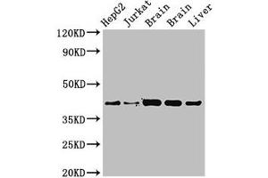 Western Blot Positive WB detected in: HepG2 whole cell lysat, Jurkat whole cell lysate, Rat brain tissue, Mouse brain tissue, Mouse liver tissue All lanes: IDH3A antibody at 3. (IDH3A antibody  (AA 28-108))