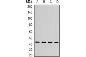 Western blot analysis of ST3GAL5 expression in BT474 (A), SHSY5Y (B), mouse brain (C), rat brain (D) whole cell lysates.
