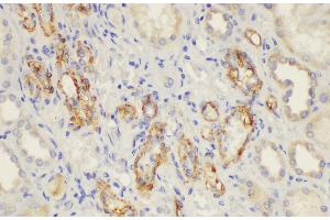 Immunohistochemistry of paraffin-embedded Human kidney using CD146 Ployclonal Antibody at dilution of 1:50. (MCAM antibody)