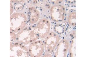 Used in DAB staining on fromalin fixed paraffin- embedded Kidney tissue (ERCC2 antibody  (AA 404-637))