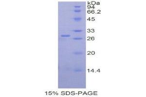 SDS-PAGE (SDS) image for MOK Protein Kinase (MOK) (AA 173-418) protein (His tag) (ABIN1877877) (MOK Protein (AA 173-418) (His tag))