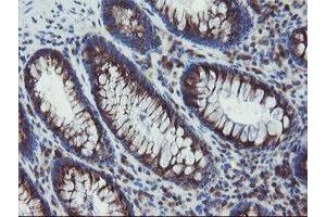 Immunohistochemical staining of paraffin-embedded Human colon tissue using anti-ACBD3 mouse monoclonal antibody. (ACBD3 antibody)