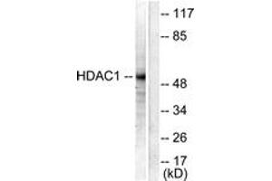 Western Blotting (WB) image for anti-Histone Deacetylase 1 (HDAC1) (AA 433-482) antibody (ABIN2879124) (HDAC1 antibody  (AA 433-482))