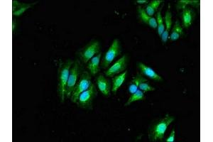 Immunofluorescent analysis of Hela cells using ABIN7145493 at dilution of 1:100 and Alexa Fluor 488-congugated AffiniPure Goat Anti-Rabbit IgG(H+L) (GLB1 antibody  (AA 317-455))
