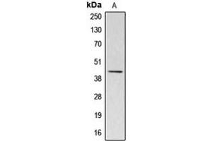 Western blot analysis of Kappa-actin expression in HuvEc (A) whole cell lysates. (ACTBL3 antibody  (Center))