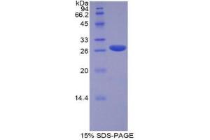 SDS-PAGE (SDS) image for Runt-Related Transcription Factor 2 (RUNX2) (AA 299-521) protein (His tag) (ABIN2122029)
