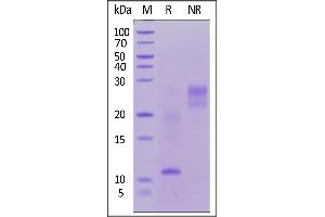 SDS-PAGE (SDS) image for Thymic Stromal Lymphopoietin (TSLP) (AA 29-159) (Active) protein (His tag,AVI tag,Biotin) (ABIN7457999)