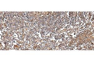 Immunohistochemistry of paraffin-embedded Human tonsil using VSIG8 Polyclonal Antibody at dilution of 1/30 (VSIG8 antibody)