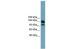 WB Suggested Anti-LRRC66 Antibody Titration:  0. (LRRC66 antibody  (Middle Region))