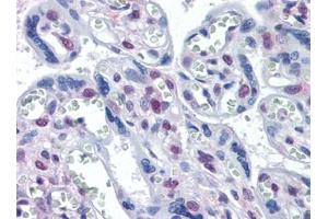 Immunohistochemistry (IHC) image for anti-serine/threonine Kinase 17a (STK17A) (AA 301-414) antibody (ABIN614691) (STK17A antibody  (AA 301-414))
