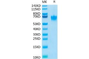 Biotinylated Human CEACAM-6 on Tris-Bis PAGE under reduced condition. (CEACAM6 Protein (His-Avi Tag,Biotin))