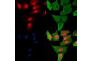 Phospho-Foxp3 (Ser19) Antibody staining A549 cells(H2O2 treatment) by IF/ICC.