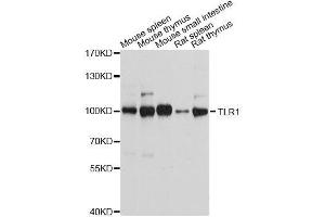 Western Blotting (WB) image for anti-Toll-Like Receptor 1 (TLR1) (AA 30-290) antibody (ABIN3023655)
