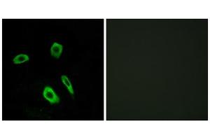 Immunofluorescence analysis of LOVO cells, using EDG7 antibody.