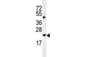 Bax antibody western blot analysis in HL-60 lysate