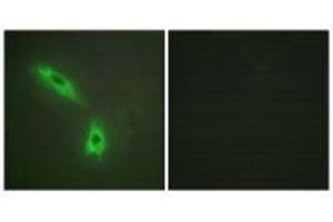 Immunofluorescence analysis of HeLa cells, using TNFC antibody. (LTB antibody  (C-Term))